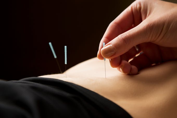 L’hypnose et l'acupuncture peuvent-elles aider à tomber enceinte ?