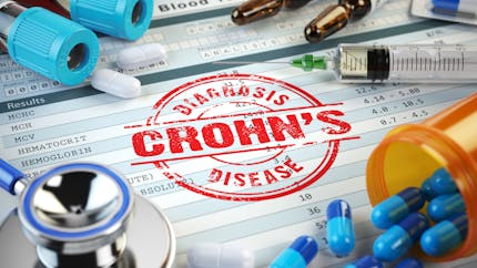 Quels traitements pour soulager la maladie de Crohn ?