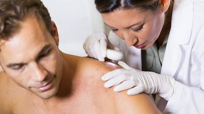 Les carcinomes : les cancers de la peau les plus fréquents