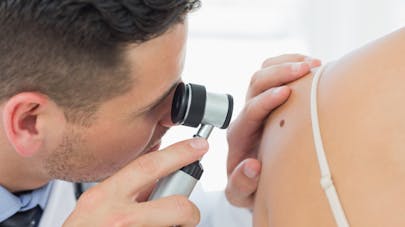 Cancer de la peau : quels sont les symptômes ?