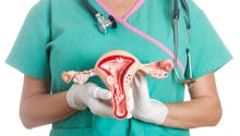 Cancer du col de l’utérus : quels traitements ?