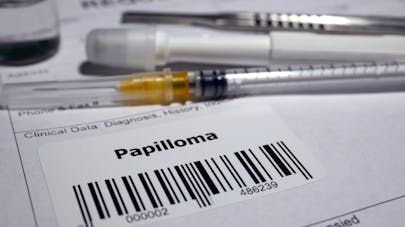 4 choses à savoir sur le papillomavirus