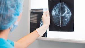 Cancers du sein agressifs : on en sait plus sur leur mécanisme d’action