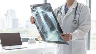 Les différents types de cancer du poumon