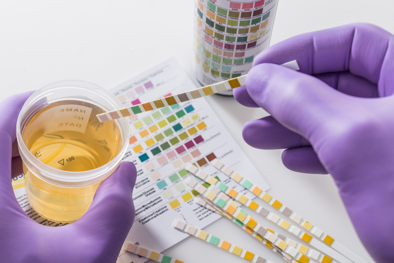 Un Test Pour Diagnostiquer Une Infection Urinaire En 30 Minutes Grace A Un Smartphone Sante Magazine