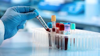 Tout savoir sur les infections respiratoires à coronavirus