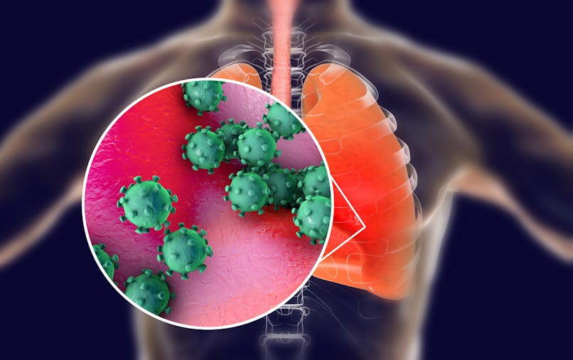 Coronavirus Ce A Quoi Ressemblent Les Poumons D Un Malade Sante Magazine Coronavirus Ce A Quoi Ressemblent Les Poumons D Un Malade Sante Magazine