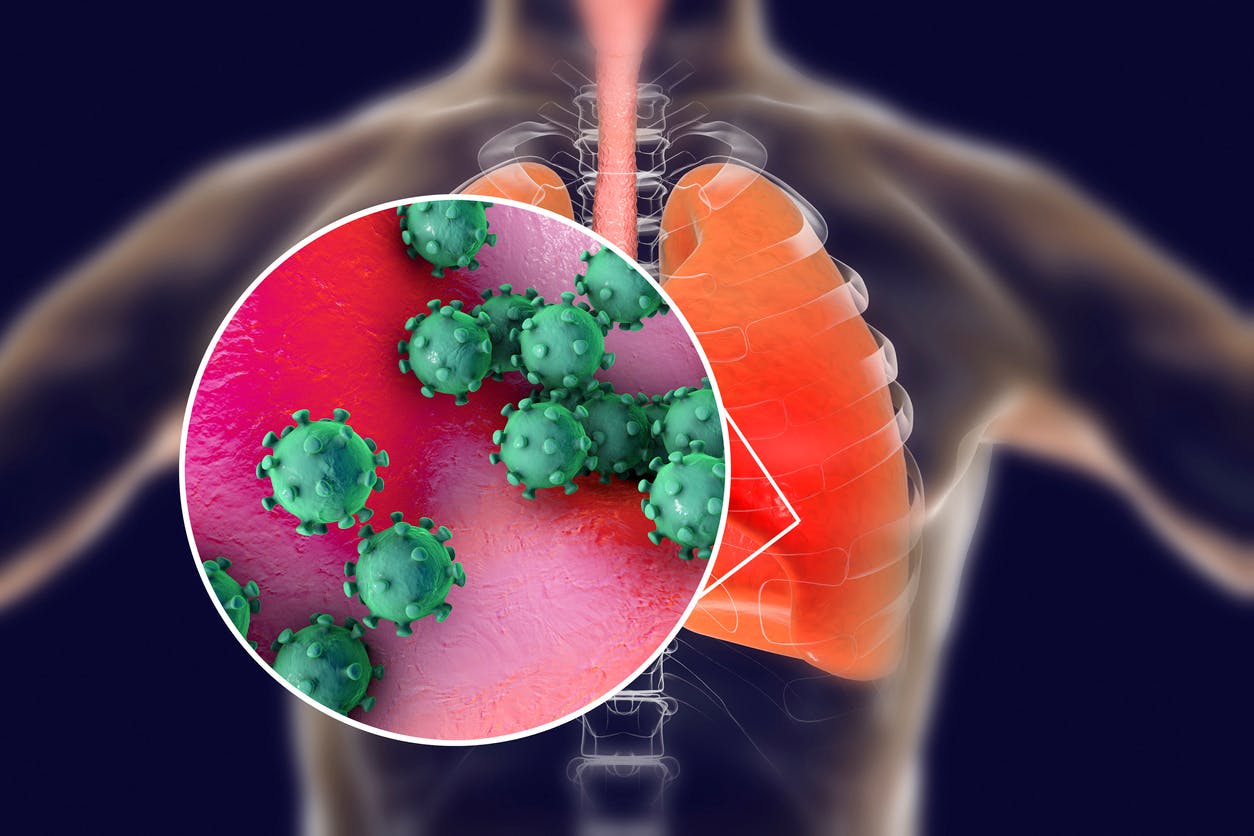 Coronavirus : ce à quoi ressemblent les poumons d'un malade ...