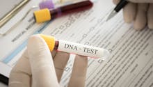 Tests génétiques en ligne : des scientifiques recommandent la plus grande prudence