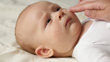Eczéma du bébé : l’application quotidienne d'émollient n’empêche pas son apparition