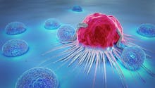 Comment détecter et traiter les métastases d’un cancer ?