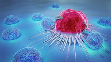 Comment détecter et traiter les métastases d'un cancer ? 