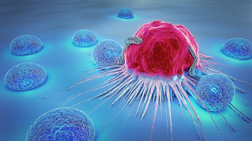 Cancer : comment détecter et traiter les métastases ? 