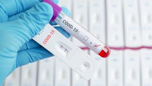 Patient zéro, personne contact… comment limiter la propagation du coronavirus Covid-19 ?