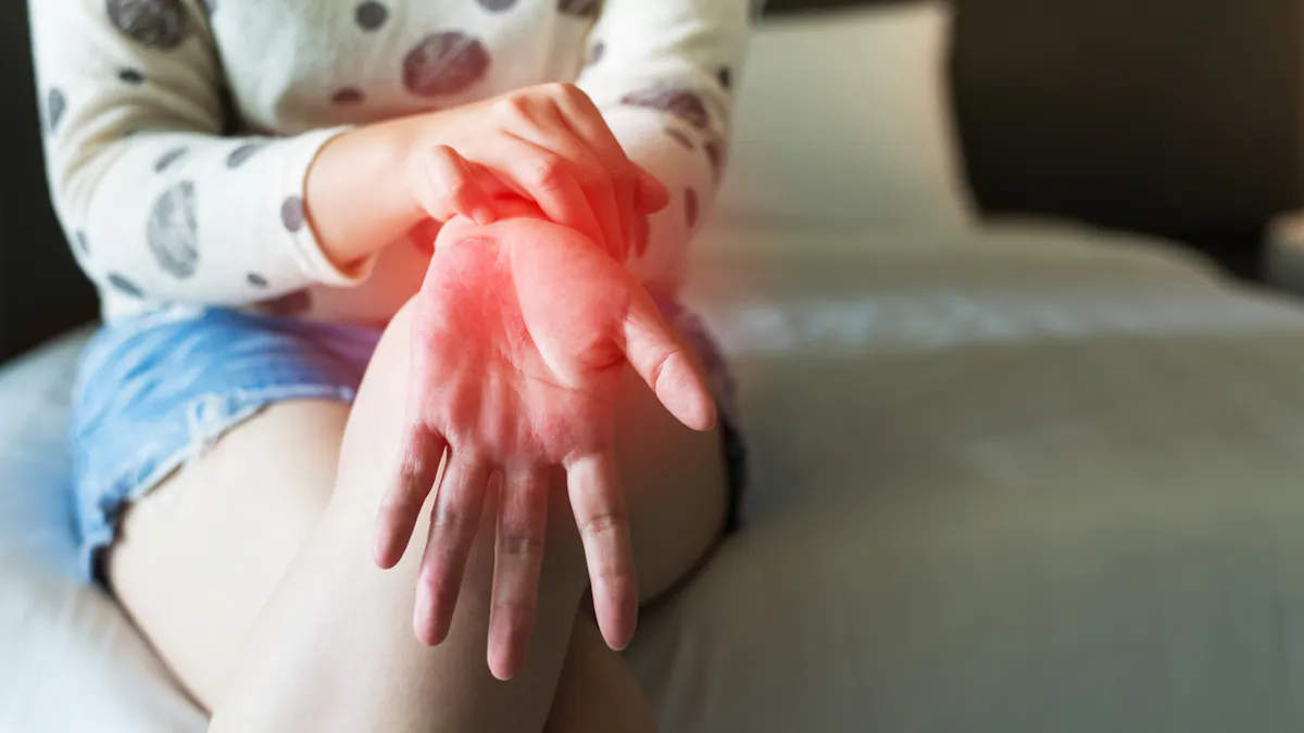 Eczema Et Coronavirus Comment Gerer L Epidemie Sante Magazine Eczema Et Coronavirus Comment Gerer L Epidemie Sante Magazine