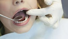 Coronavirus : quels sont les soins dentaires maintenus ?