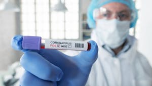 Coronavirus : les résultats prometteurs des premiers tests sérologiques