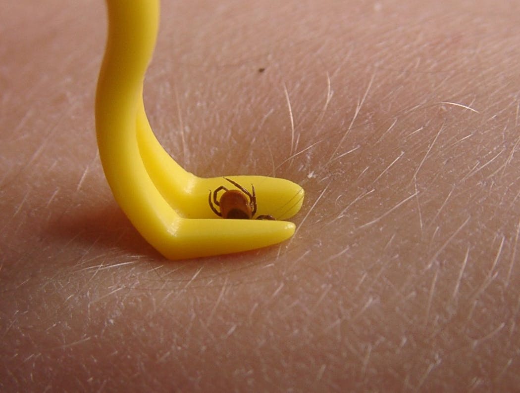 Piqure Et Morsure De Tique Les Bons Reflexes Sante Magazine Piqure Et Morsure De Tique Les Bons Reflexes Sante Magazine