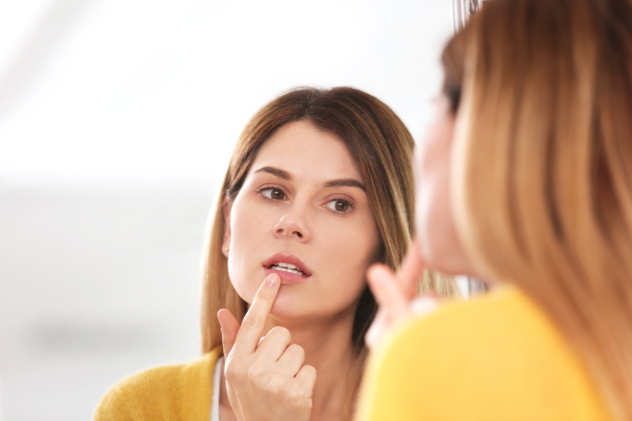 Les Taux D Herpes Labial Diminuent Chez Les Enfants Sante Magazine