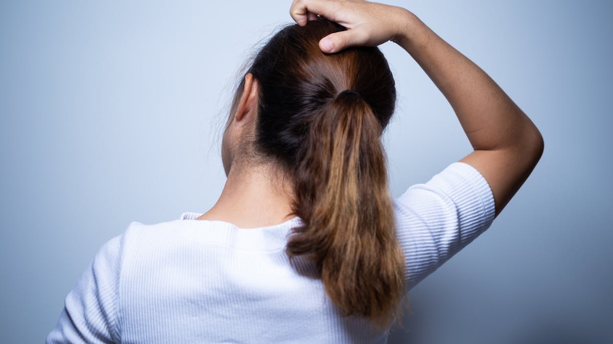 Eczema Du Cuir Chevelu Dermite Seborrheique Comment S En Debarrasser Sante Magazine Eczema Du Cuir Chevelu Dermite Seborrheique Comment S En Debarrasser Sante Magazine