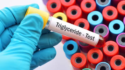 Tout savoir sur le dosage des triglycérides