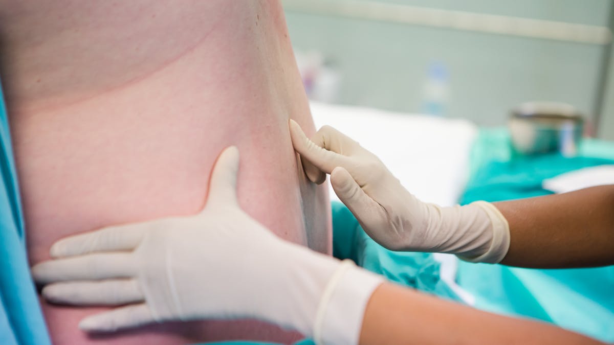 Ponction Lombaire Deroulement Risques Contre Indications Sante Magazine Ponction Lombaire Deroulement Risques Contre Indications Sante Magazine