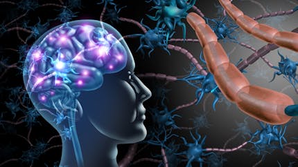 Sclérose en plaques : ce qu'il faut savoir sur cette maladie neurologique chronique
