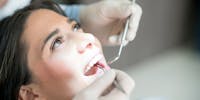 Soins dentaires : faut-il prendre des antibiotiques ?