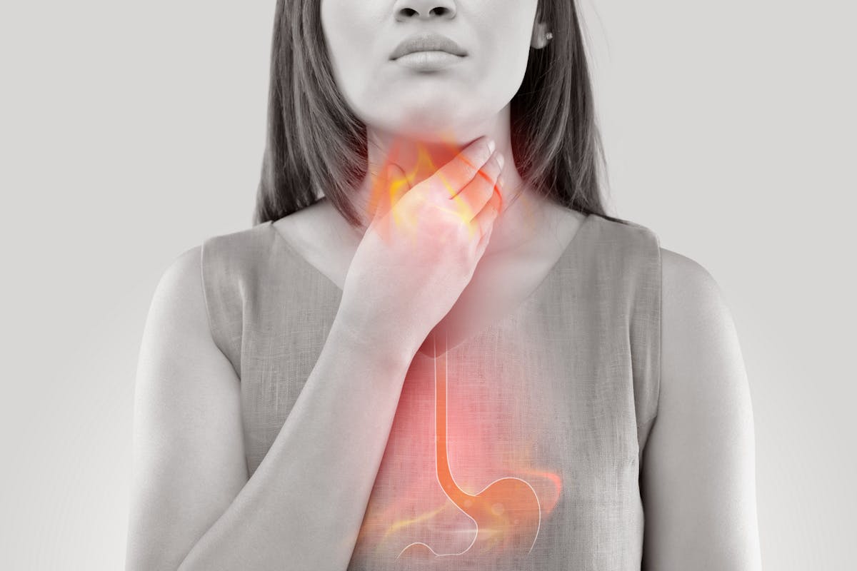 RGO et toux : symptômes et traitements des reflux | Santé Magazine