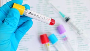 Qu'est-ce que la maladie à virus de Marburg détectée en Guinée ?