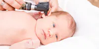 Quand Donner Des Antibiotiques A Bebe Et Lesquels Privilegier Sante Magazine Quand Donner Des Antibiotiques A Bebe Et Lesquels Privilegier Sante Magazine