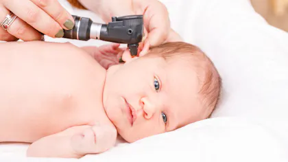 Typam Perfore Tympan perforé, tympan percé : causes, symptômes, traitements | Santé ...