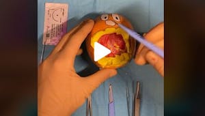 Chirurgies : un étudiant en médecine cartonne sur TikTok grâce à des opérations de fruits