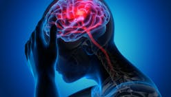 Accident vasculaire cérébral (AVC) : ce qu'il faut savoir