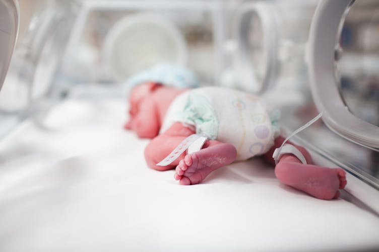 Le nouveau-né de faible poids de naissance : prise en charge des 3  premières années