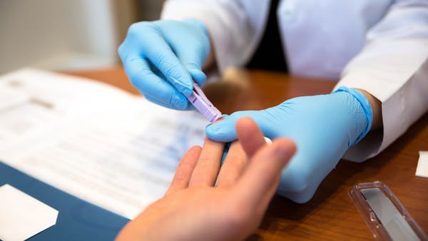 Tests VIH : quand et comment se faire dépister ?