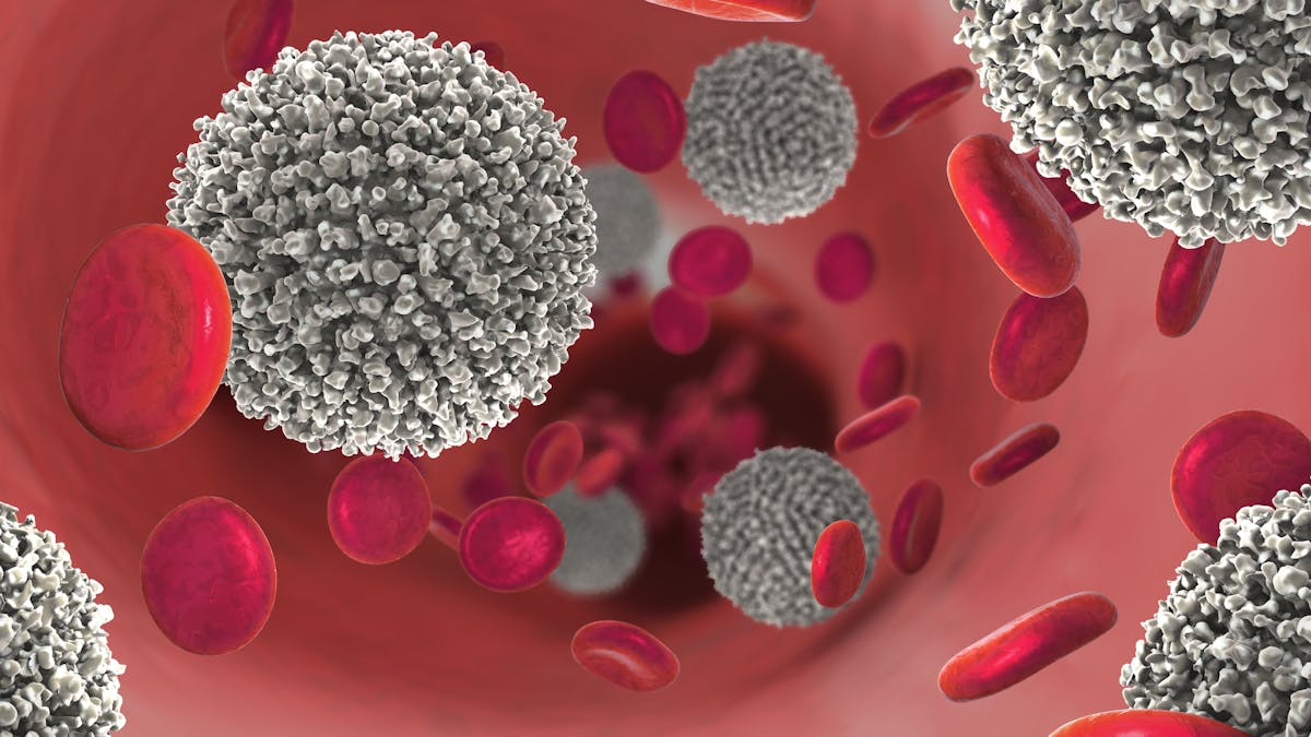 cellules-leucémiques-conduisant-au-cancer-du-sang