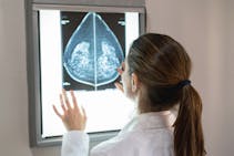 Cancer du sein triple négatif métastatique : un second traitement autorisé en France