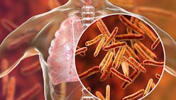 Tuberculose : ce qu'il faut savoir sur cette maladie infectieuse