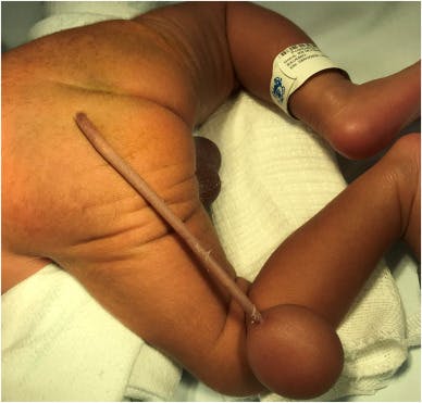 A human baby is born with a real cock