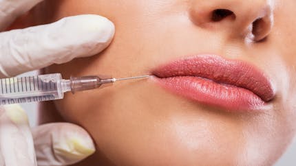 Chirurgie esthétique : les injections pour les lèvres n'ont plus la côte !