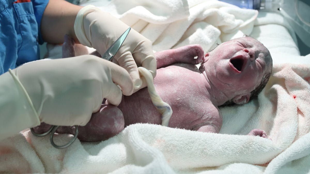 Nouveau-né avec son cordon ombilical.