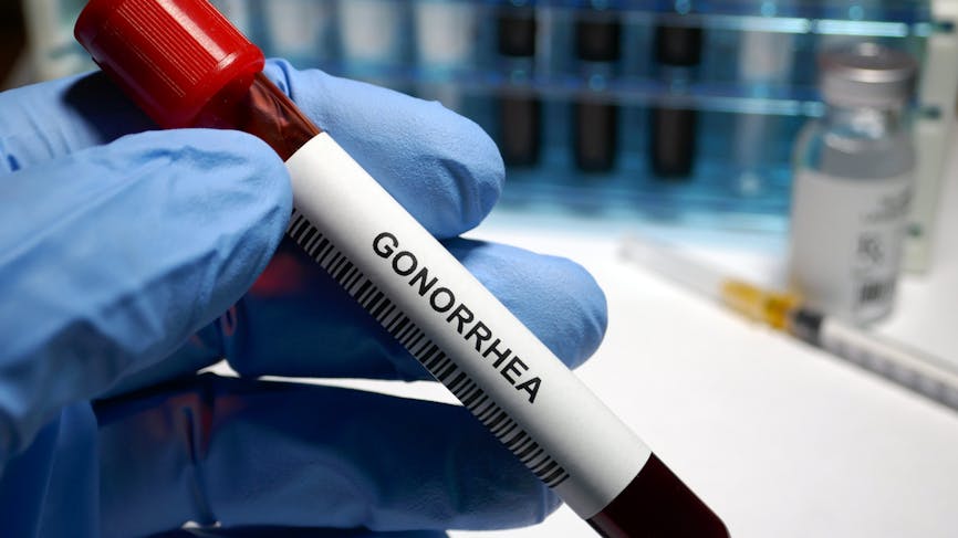 Un échantillon de sang pour dépister la gonorrhée
