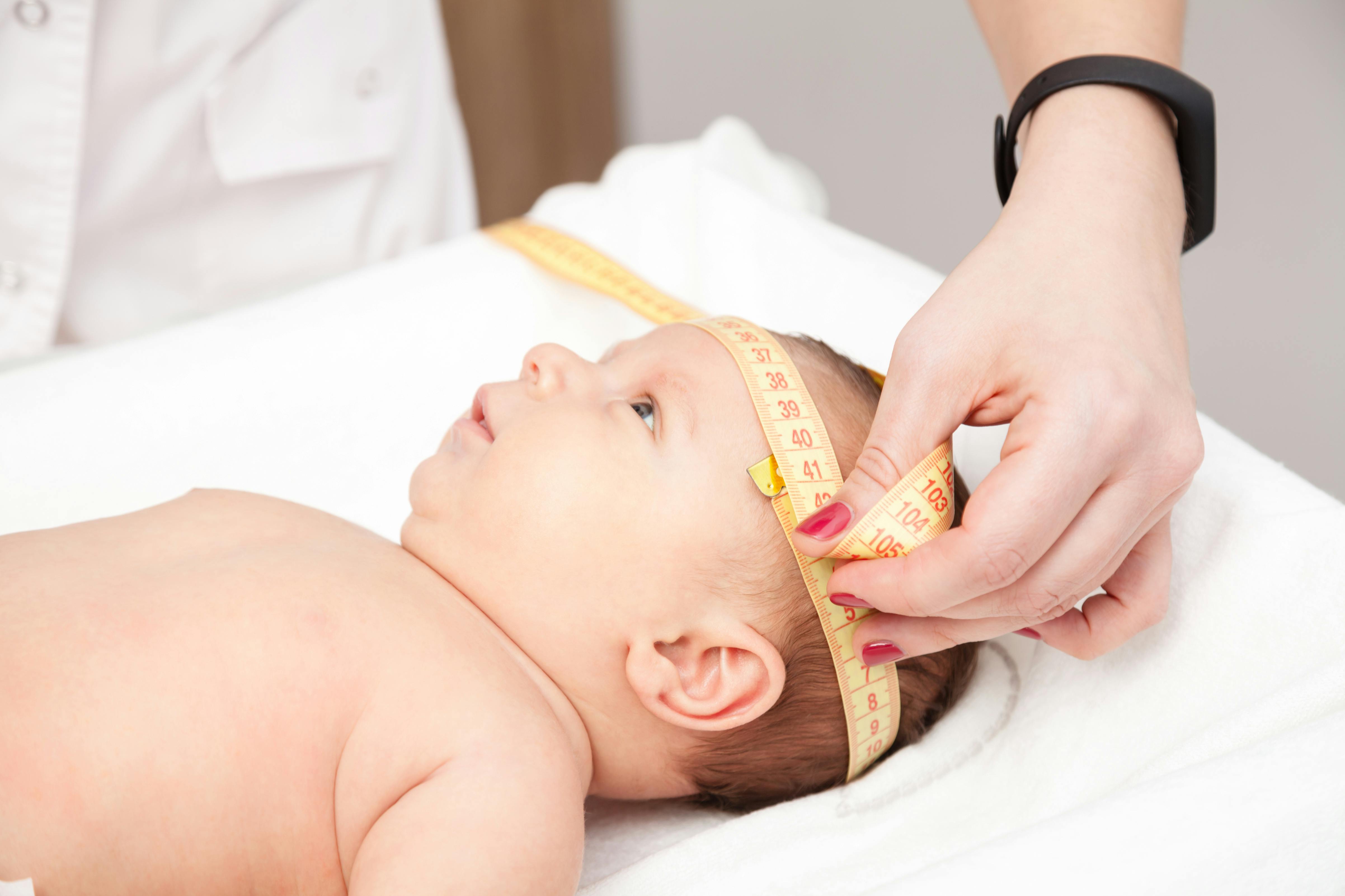 Маленькая окружность головы. Измерение окружности головы новорожденного. Измерение окружности головы у детей до 1 года. Измерение окружности головы и грудной клетки у детей. Антропометрия головы ребенка.
