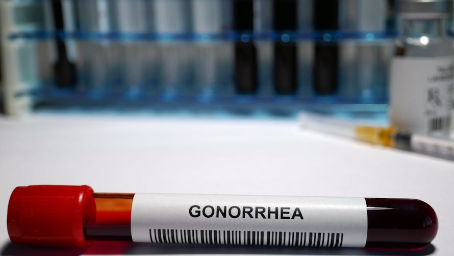 test-gonorrhee-blennorragie