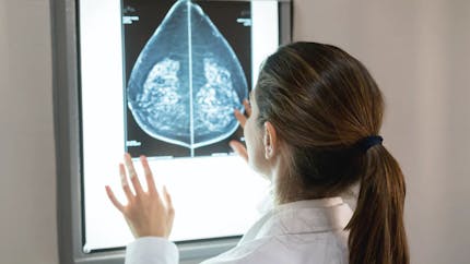 Un test pour identifier les personnes à risque génétique plus élevé de cancer du sein