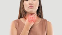 Hyperthyroïdie : comprendre ce déréglement de la glande thyroïde