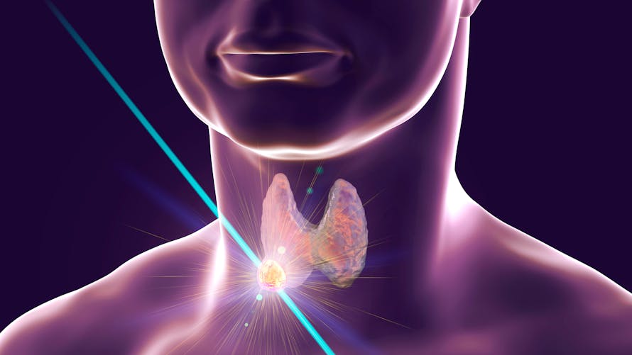 Nodule thyroïdien : dépistage, types, traitements | Santé Magazine