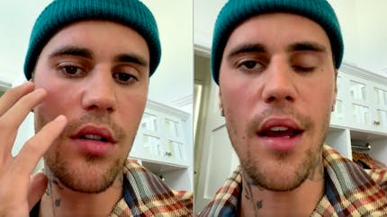 Atteint d'un syndrome rare, Justin Bieber révèle être paralysé du visage