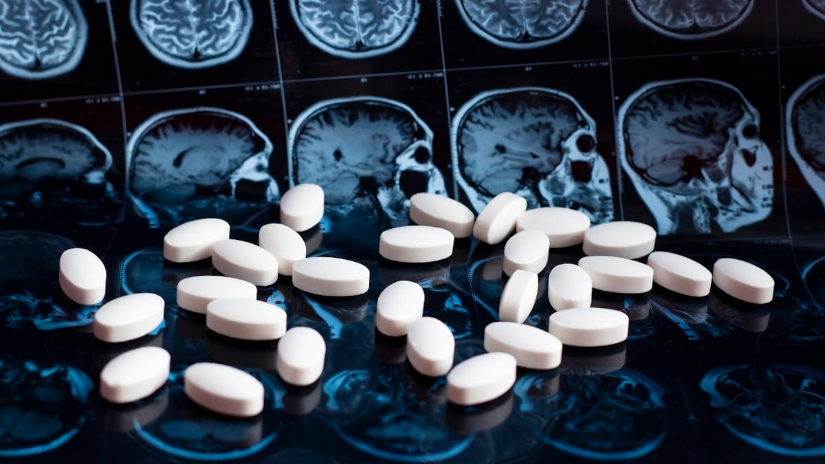 Selon une étude, des lésions cérébrales ciblées pourraient guérir des addictions